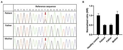 Case Report: A Novel Compound Heterozygous Mutation in IL-10RA in a Chinese Child With Very Early-Onset Inflammatory Bowel Disease